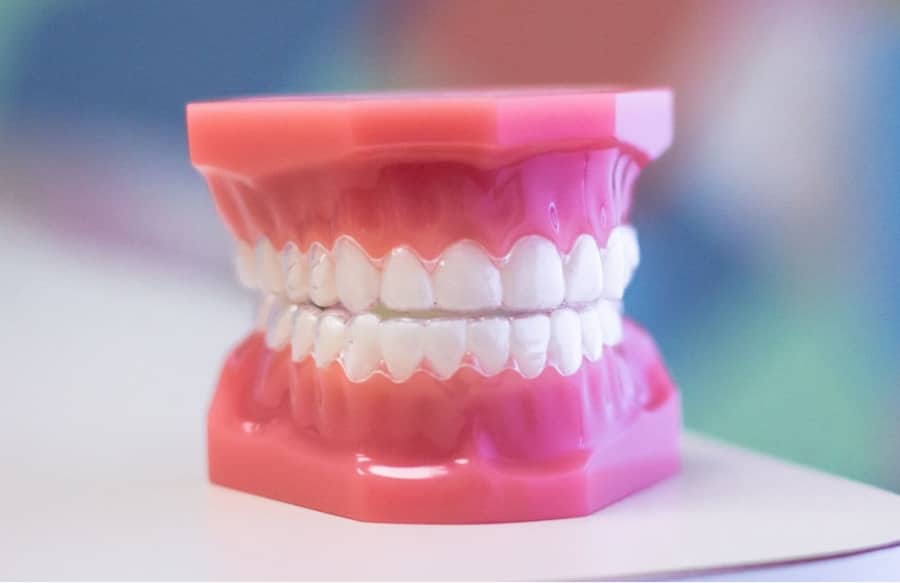 invisalign on plastic model