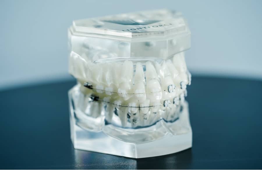 lightforce on plastic model